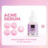 Scarlett Acne Serum