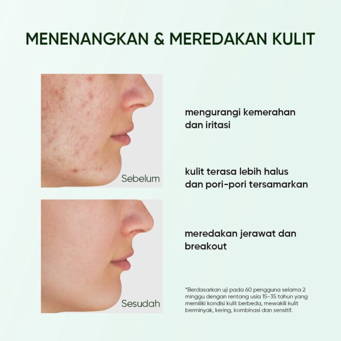 Skintific Mugwort Acne Clay Stick - Gambar 3