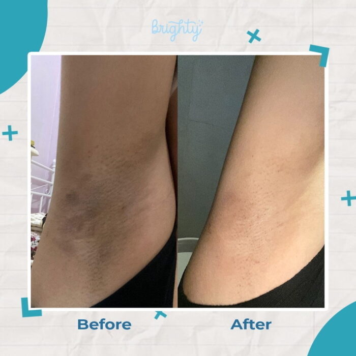 Brighty Gel Glowing Underarm - Gambar 3