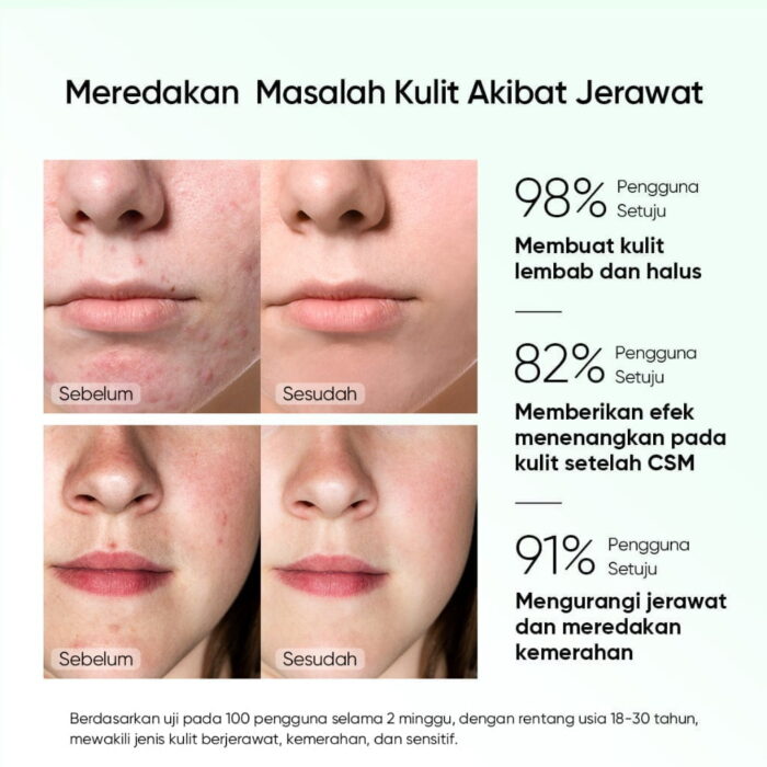Skintific Pure Centella Acne Calming Toner - Gambar 5
