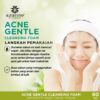 Azarine Acne Gentle Cleansing Foam 60ml - Gambar 4