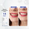 NEWLAB Pro Teeth Whitening Kit | Alat Pemutih Gigi Permanen - Gambar 4