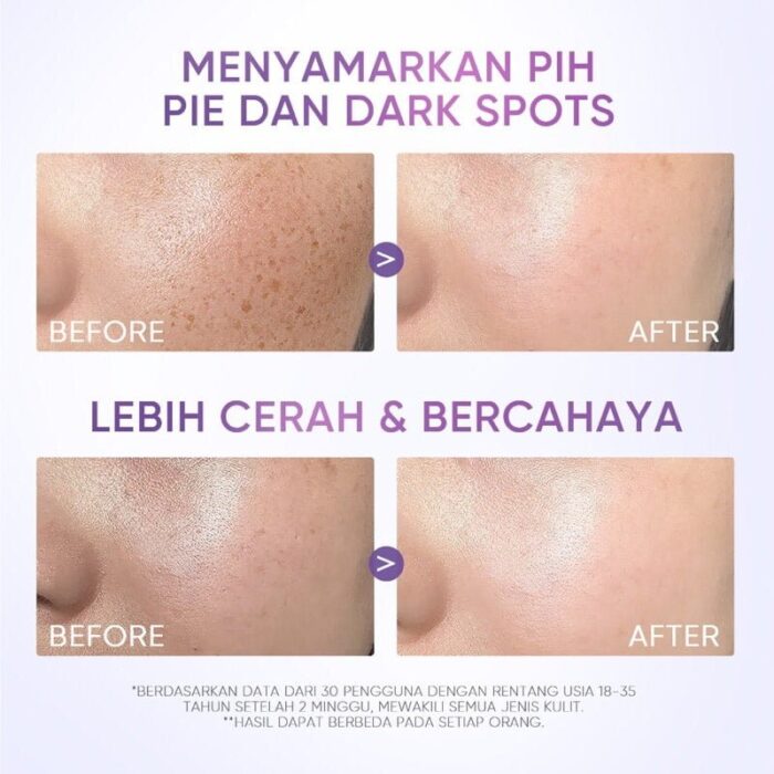 Skintific Symwhite 377 Dark Spot Moisturizer Gel 30g - Gambar 6