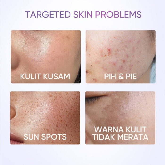 Skintific Symwhite 377 Dark Spot Moisturizer Gel 30g - Gambar 5