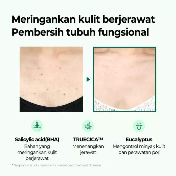 Some By Mi Aha Bha Pha Miracle Acne Clear Body Cleanser - Gambar 2