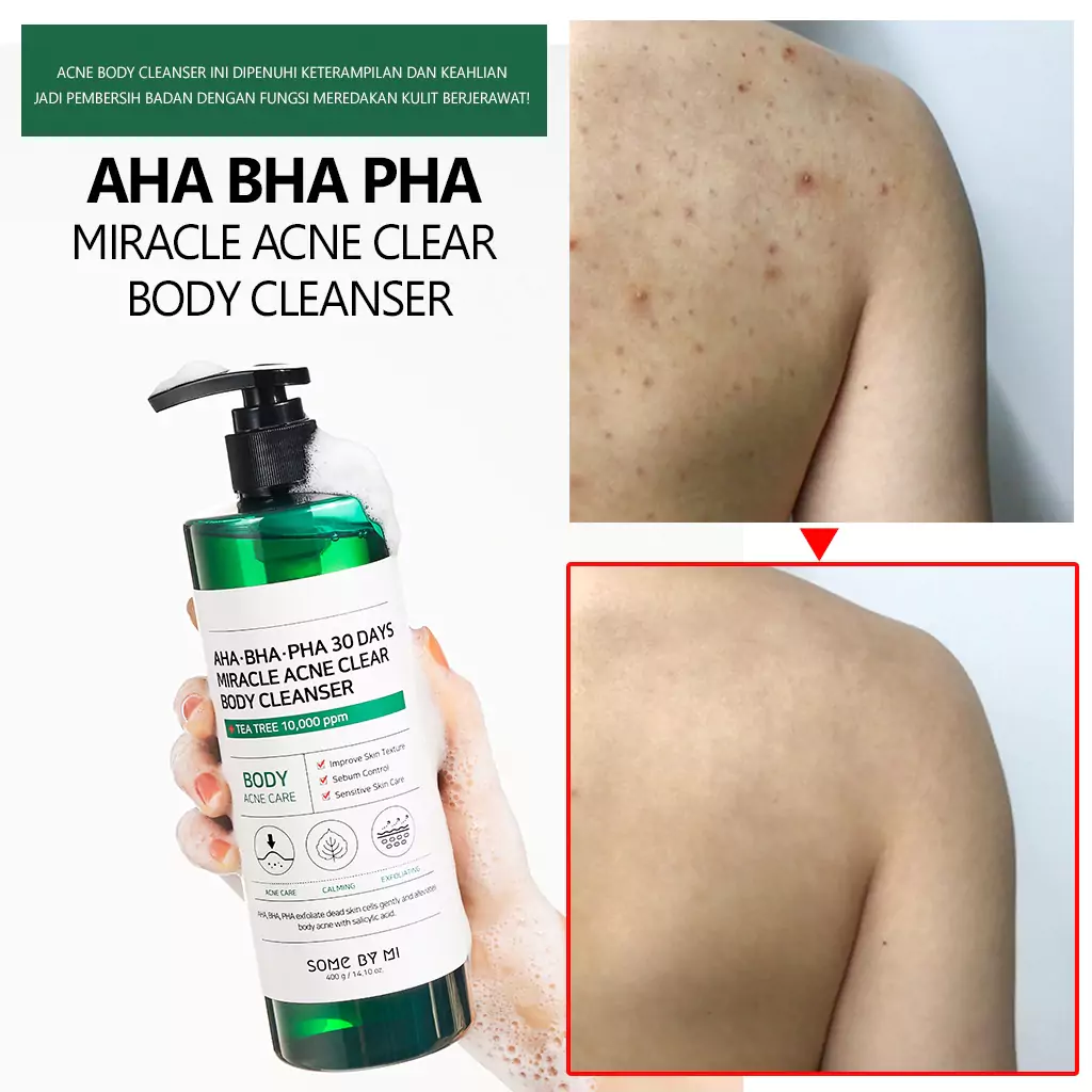 Some By Mi Aha Bha Pha Miracle Acne Clear Body Cleanser6 Some By Mi Aha Bha Pha Miracle Acne Clear Body Cleanser - Gambar 3