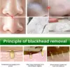 Allphv Blackhead Mask Pembersih Komedo Step 1 - Gambar 4