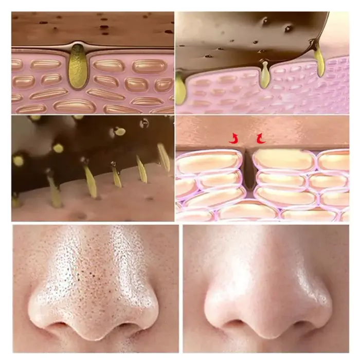 Allphv Blackhead Mask Pembersih Komedo Step 1 - Gambar 6
