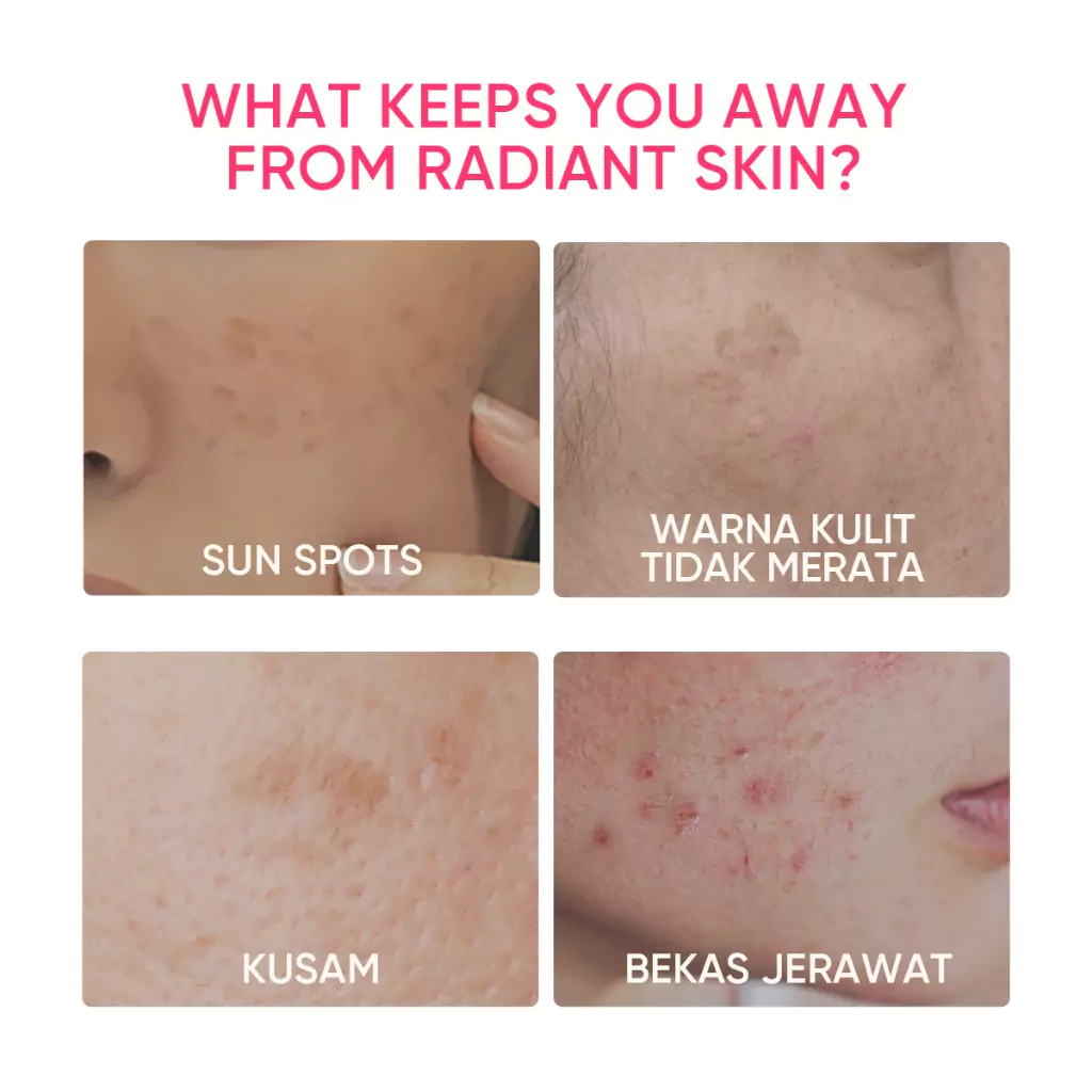 Skintific MSH Niacinamide Brightening Moisture Gel 80 gr2 Skintific MSH Niacinamide Brightening Moisture Gel 80 gr - Gambar 6