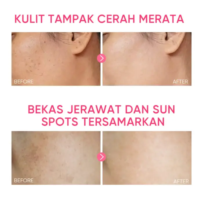 Skintific MSH Niacinamide Brightening Moisture Gel 80 gr - Gambar 5