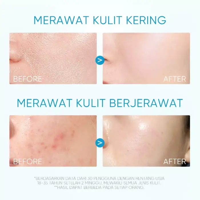 Skintific 5X Ceramide Barrier Moisturizer Gel Big Size 80g - Gambar 5
