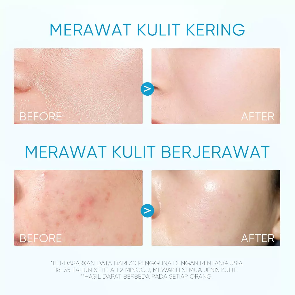 Skintific 5X Ceramide Barrier Moisturizer Gel Big Size 80g2 Skintific 5X Ceramide Barrier Moisturizer Gel Big Size 80g - Gambar 5