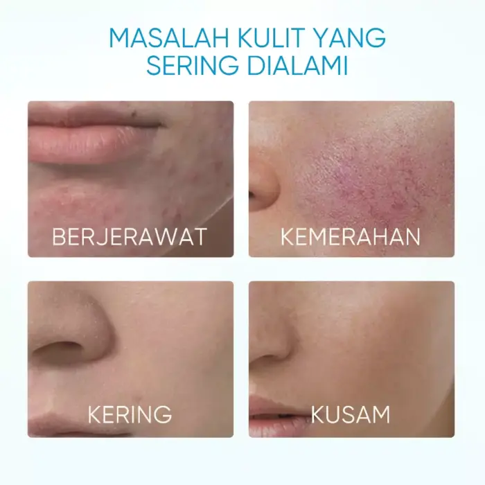 Skintific 5X Ceramide Barrier Moisturizer Gel Big Size 80g - Gambar 4