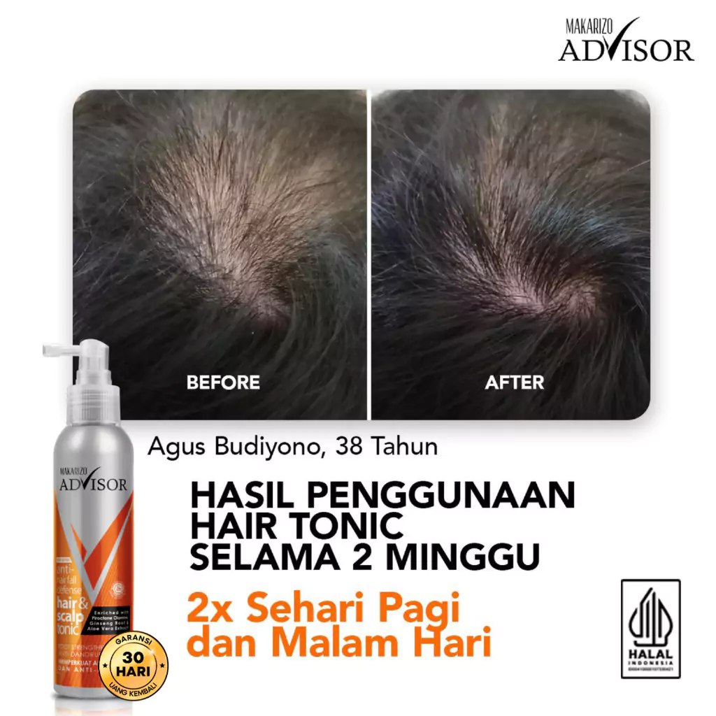 Makarizo Advisor Hair & Scalp Tonic4 Makarizo Advisor Hair & Scalp Tonic 145 ml - Gambar 6