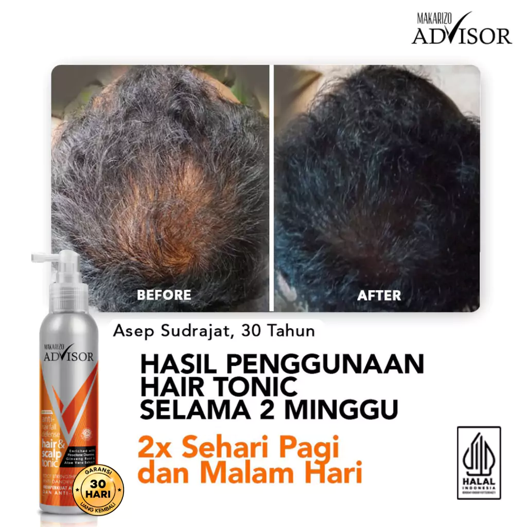 Makarizo Advisor Hair & Scalp Tonic5 Makarizo Advisor Hair & Scalp Tonic 145 ml - Gambar 5