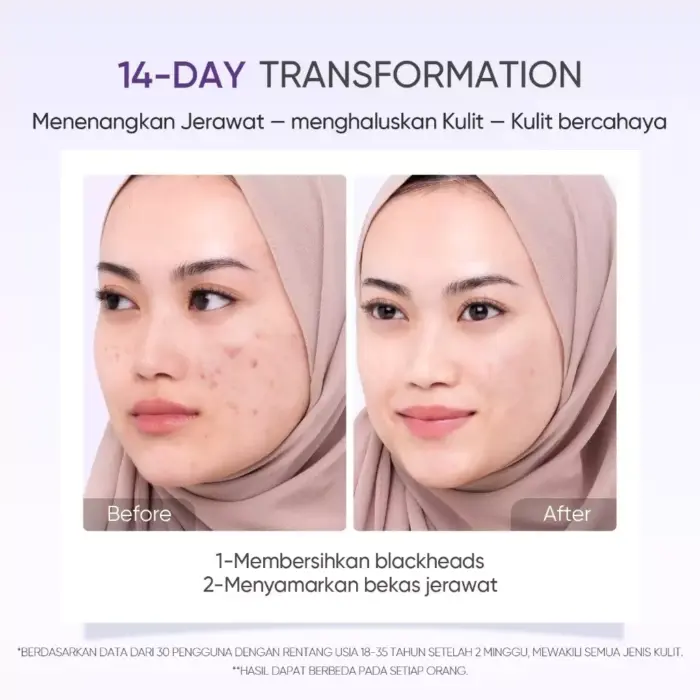 Skintific Lactic Acid Skin Renewal Exfoliating Serum - Gambar 6