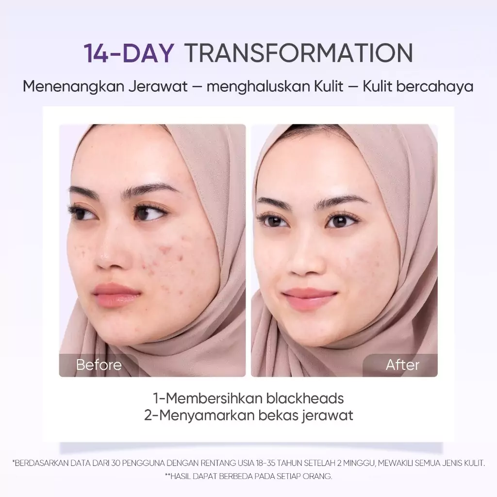 Skintific Lactic Acid Skin Renewal Exfoliating Serum 4 Skintific Lactic Acid Skin Renewal Exfoliating Serum - Gambar 6