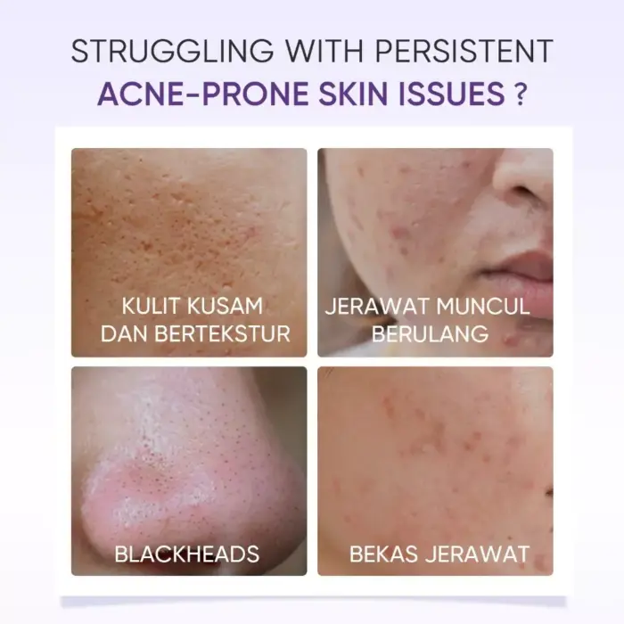 Skintific Lactic Acid Skin Renewal Exfoliating Serum - Gambar 7