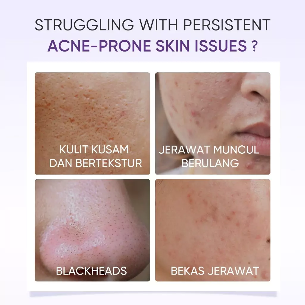 Skintific Lactic Acid Skin Renewal Exfoliating Serum 8 Skintific Lactic Acid Skin Renewal Exfoliating Serum - Gambar 7