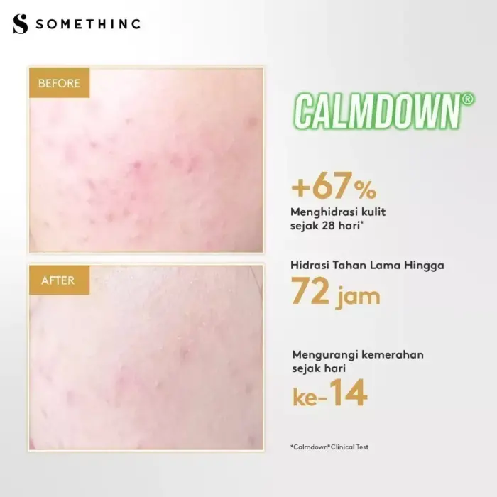 Somethinc Calm Down! Skinpair R-Cover Cream Moisturizer - Gambar 5