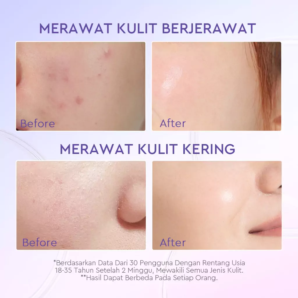 Glad2Glow Blueberry 5% Ceramide Moisturizer 2 Glad2Glow Blueberry 5% Ceramide Moisturizer - Gambar 2