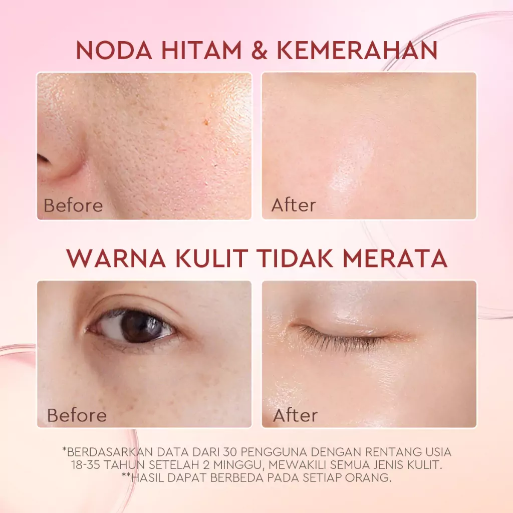 Glad2Glow Pomegranate 5% Niacinamide Brightening Moisturizer 1 Glad2Glow Pomegranate 5% Niacinamide Brightening Moisturizer - Gambar 3