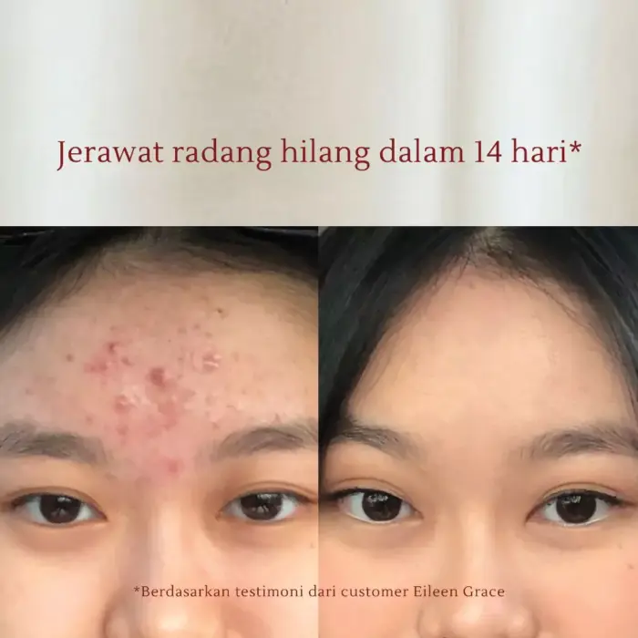 Eileen Grace Moisturize Rose Jelly Mask 300ml - Gambar 6