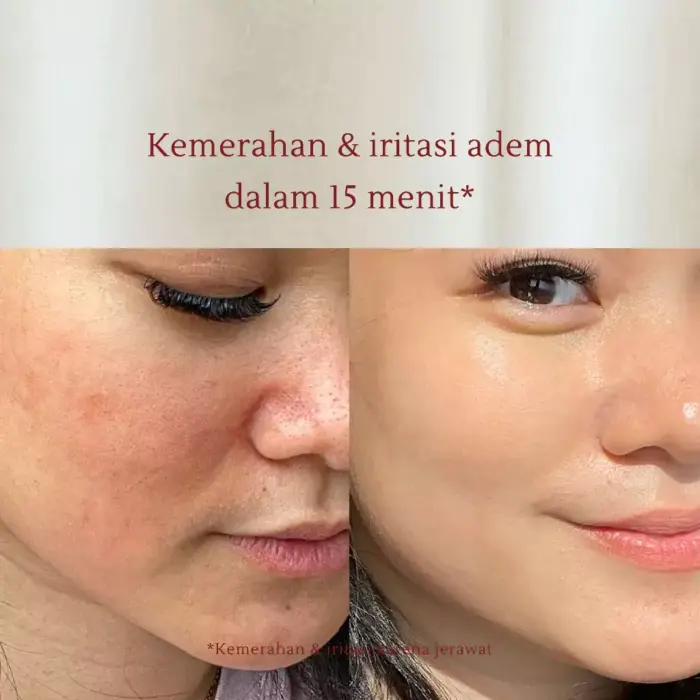 Eileen Grace Moisturize Rose Jelly Mask 300ml - Gambar 4