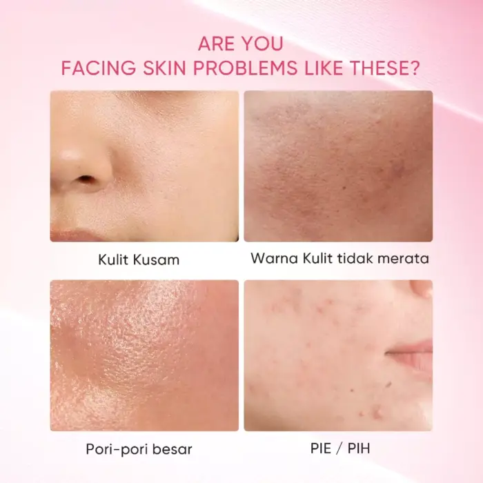 Skintific Niacinamide Bright Boost Clay Stick - Gambar 6