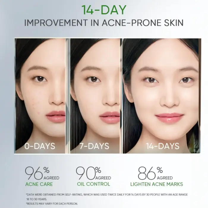 Skintific 3X Acid Anti-Acne Gel Moisturizer 30 gr - Gambar 6