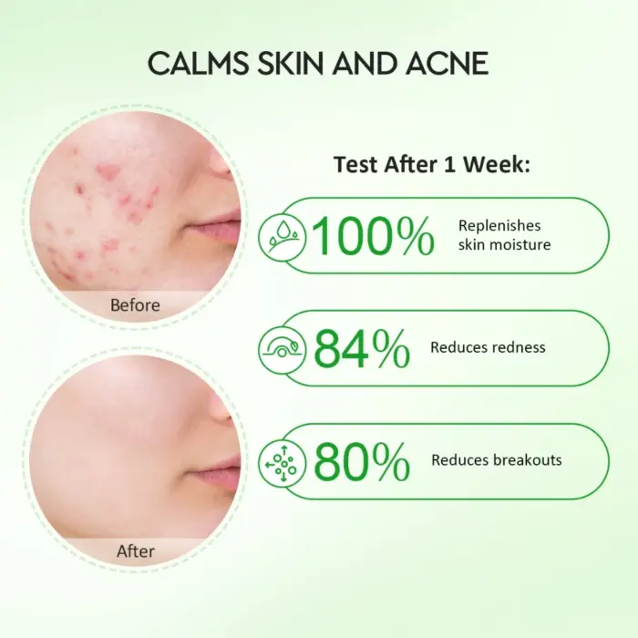 Glad2Glow Centella Allantoin Soothing Gel Moisturizer 30 gr - Gambar 4