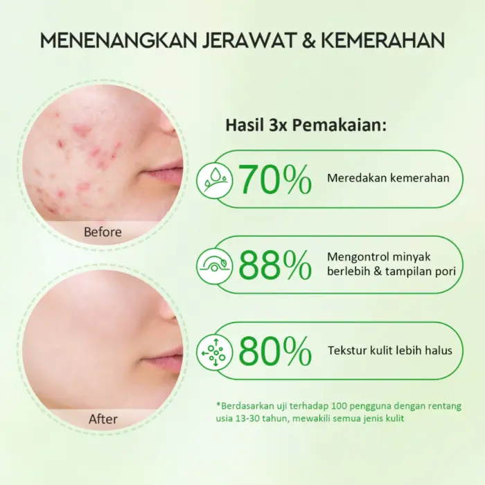 Glad2Glow Mugwort Acne Clay Stick - Gambar 3