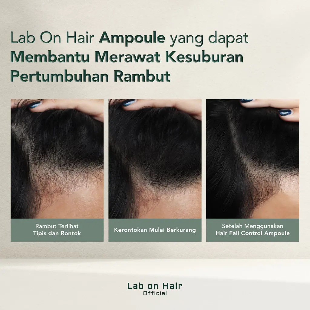 Lab On Hair Bundle Combo Anti Hair Fall Ampoule + Shampoo 1 Lab On Hair Bundle Combo Anti Hair Fall Ampoule + Shampoo - Gambar 5
