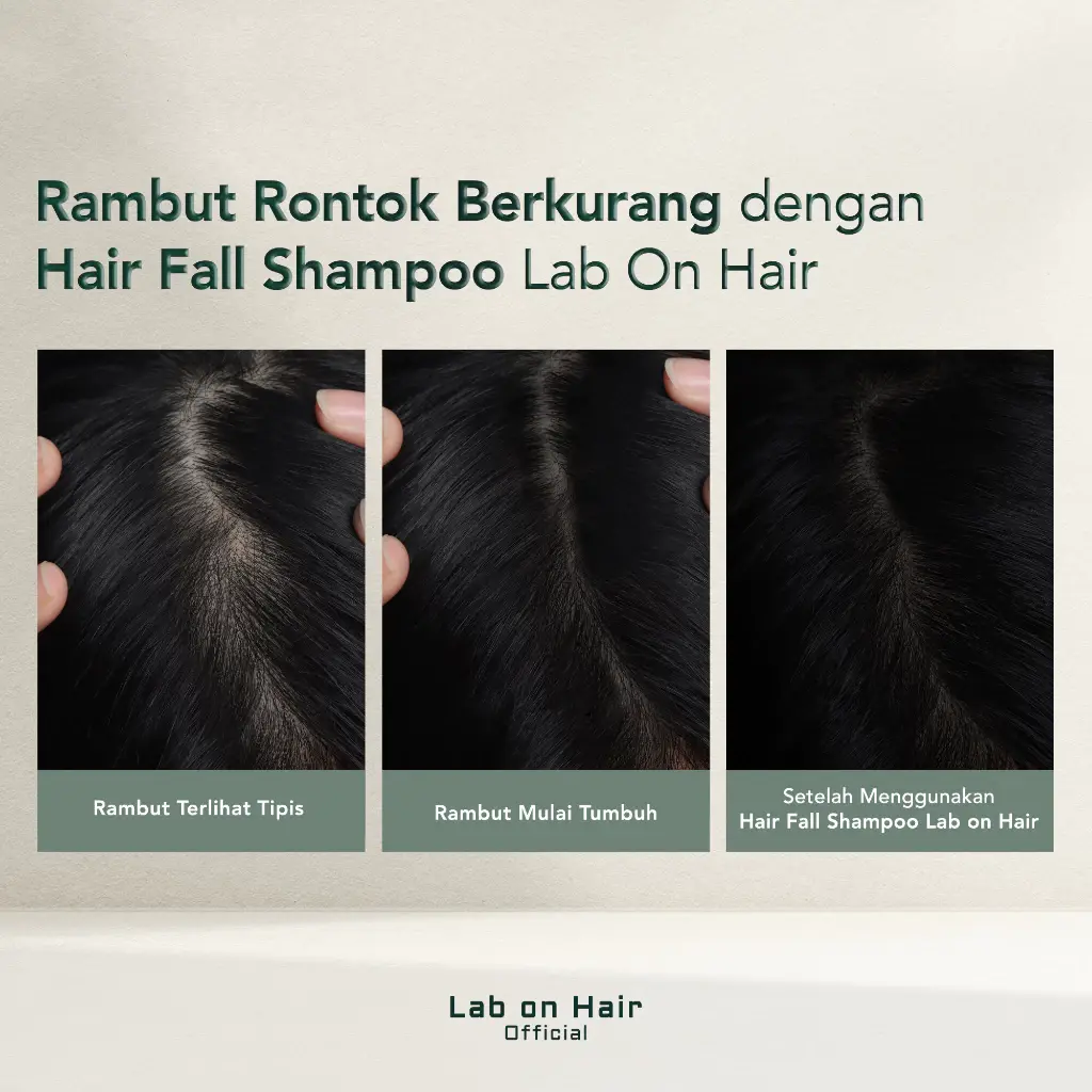 Lab On Hair Bundle Combo Anti Hair Fall Ampoule + Shampoo 2 Lab On Hair Bundle Combo Anti Hair Fall Ampoule + Shampoo - Gambar 4