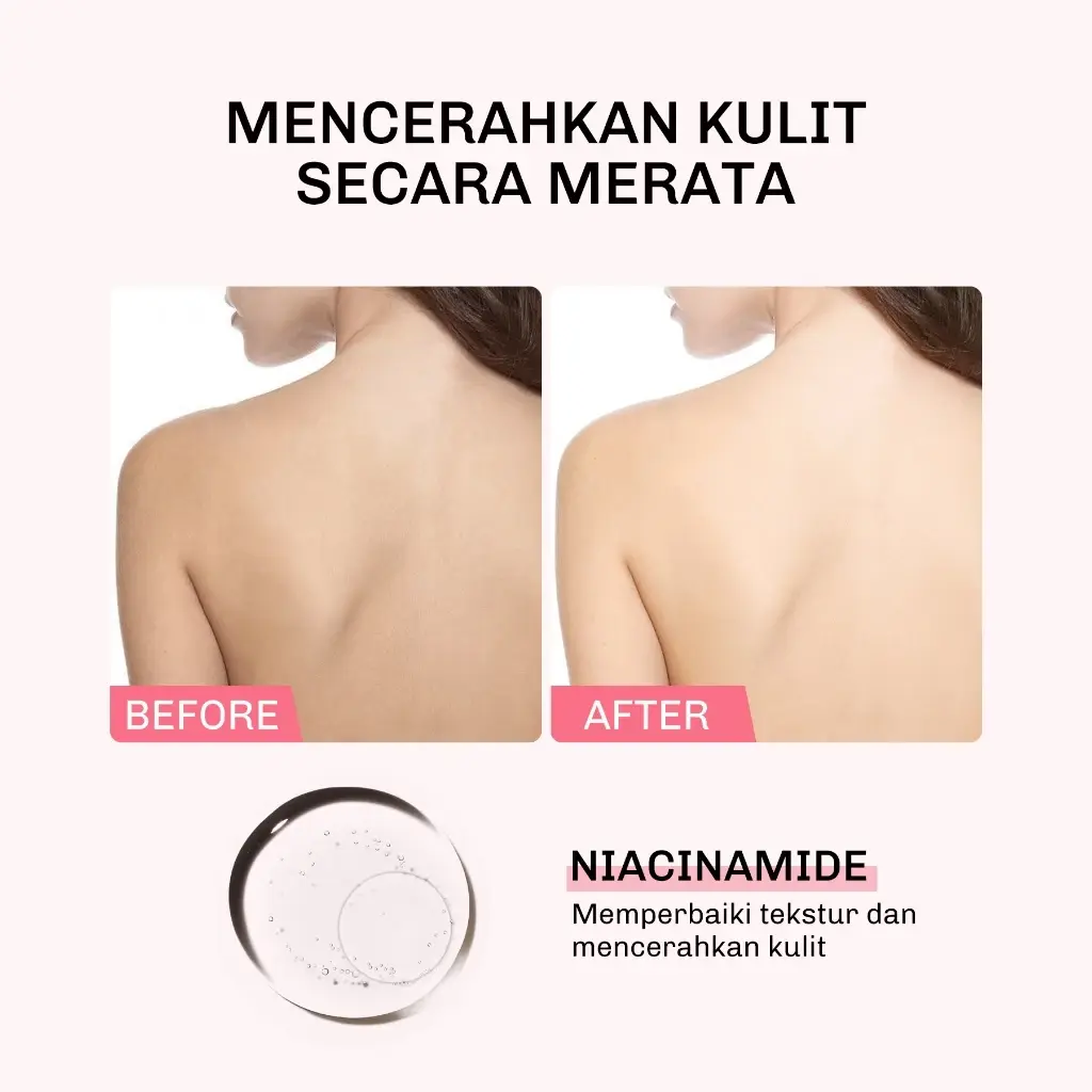 lavojoy Let It Glow Body Serum Skin Brightening 4 Lavojoy Let It Glow Body Serum Skin Brightening - Gambar 4