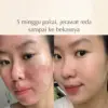 Polynia Orange Brightening Face Mask | Memudarkan Bekas Jerawat - Gambar 6