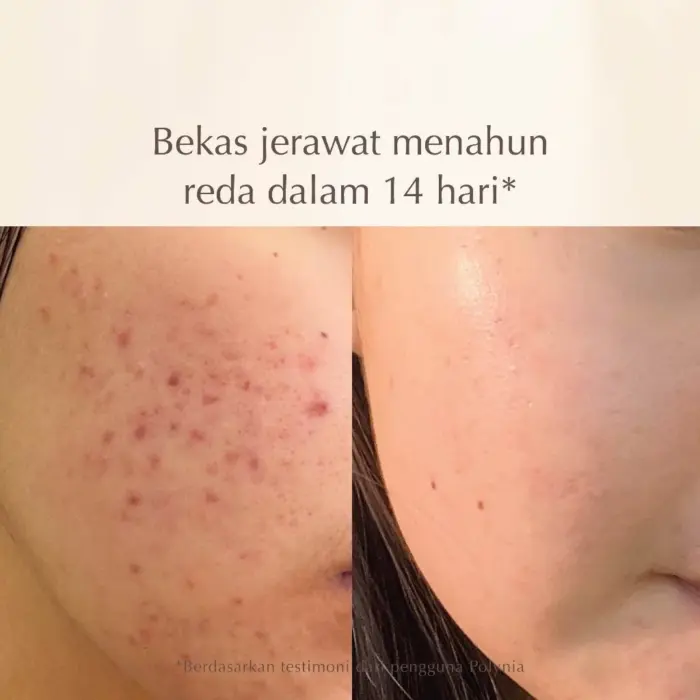 Polynia Orange Brightening Face Mask | Memudarkan Bekas Jerawat - Gambar 5