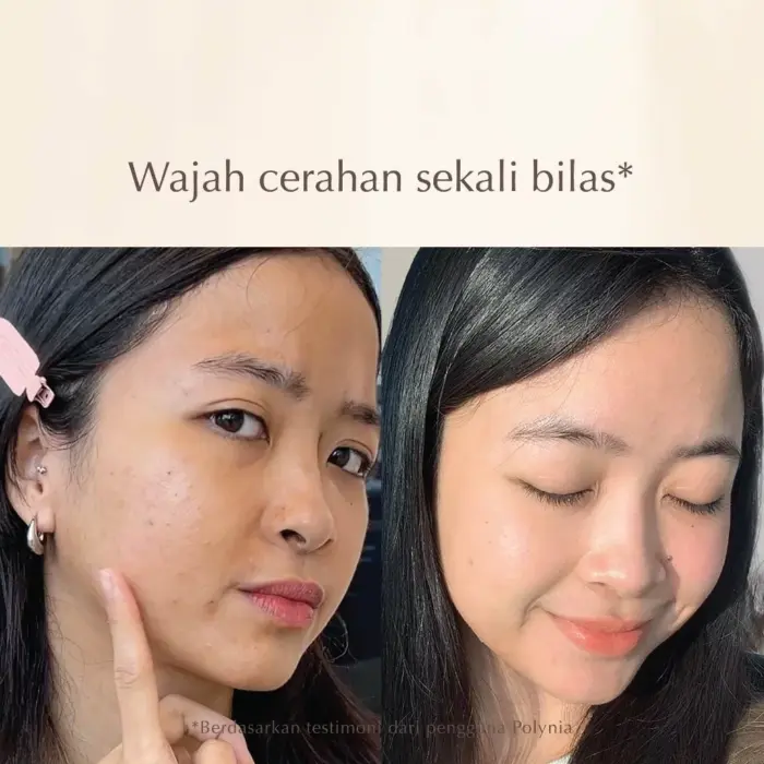 Polynia Orange Brightening Face Mask | Memudarkan Bekas Jerawat - Gambar 3