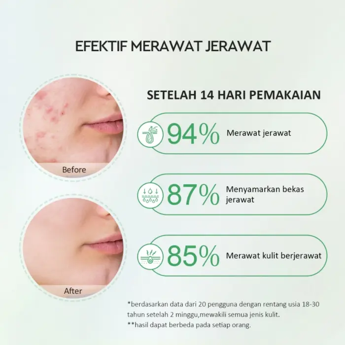 Glad2Glow Centella Salicylic Acid Power Acne Serum - Gambar 4