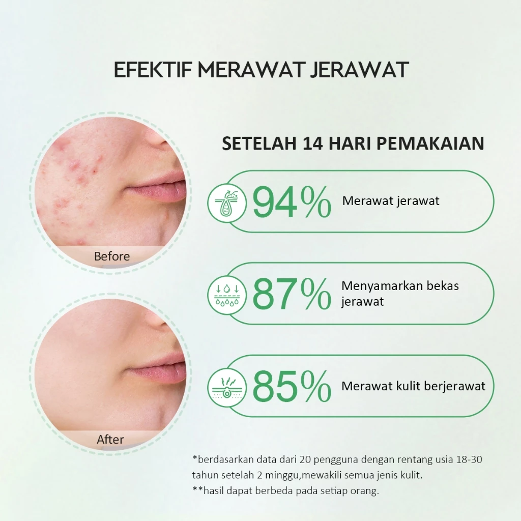 Glad2Glow Centella Salicylic Acid Power Acne Serum 2 Glad2Glow Centella Salicylic Acid Power Acne Serum - Gambar 4