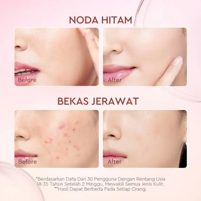 Glad2Glow Pomegranate Niacinamide Power Bright Serum - Gambar 4