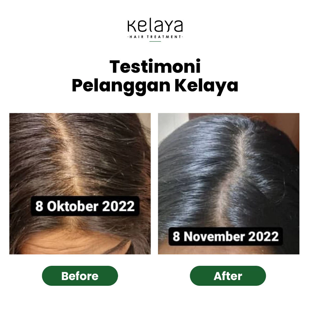 Kelaya Minyak Kemiri Penumbuh Rambut 1 Kelaya Minyak Kemiri Penumbuh Rambut 50ml - Gambar 8