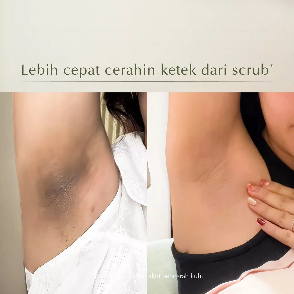 MOSSÈRU 3% Tranexamic Bright Booster Serum 2 MOSSÈRU 3% Tranexamic Bright Booster Serum - Gambar 3