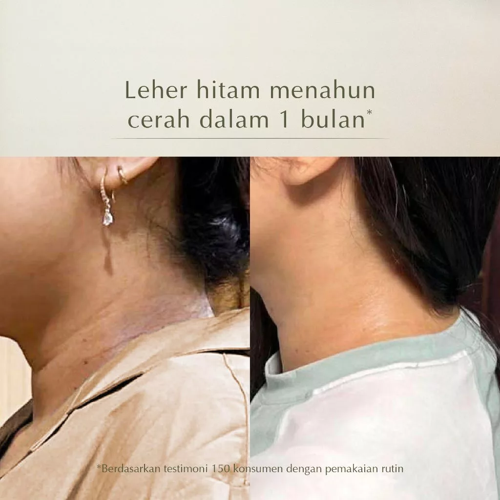 MOSSÈRU 3% Tranexamic Bright Booster Serum 4 MOSSÈRU 3% Tranexamic Bright Booster Serum - Gambar 5