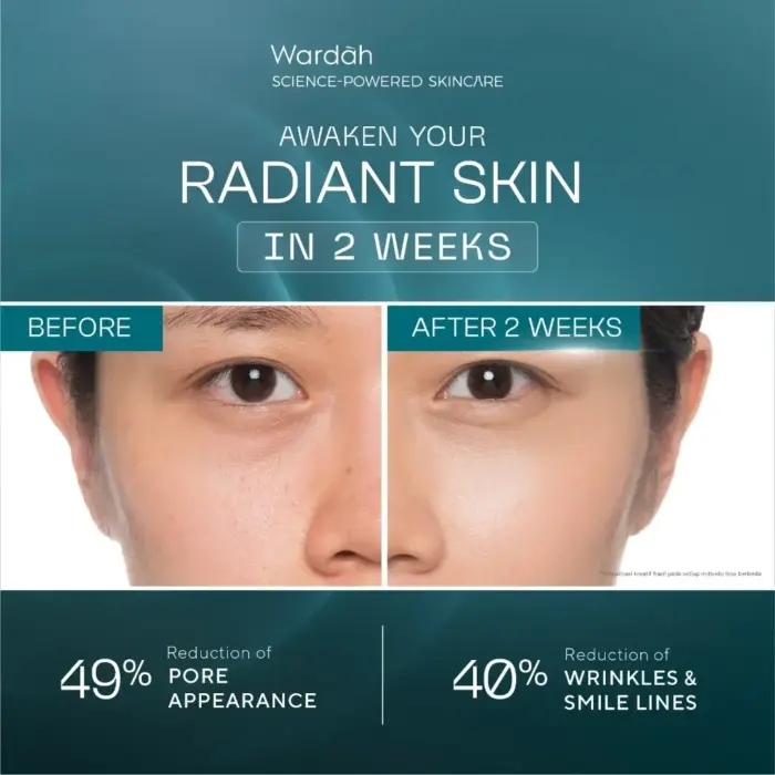 Wardah Radiant Resurfacing Retinal Cysteamine Serum 30 ml - Gambar 5
