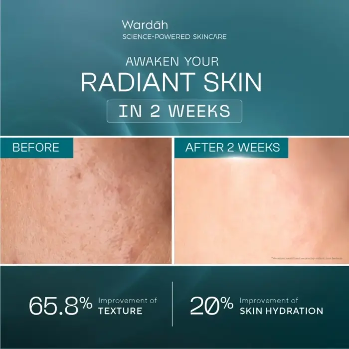 Wardah Radiant Resurfacing Retinal Cysteamine Serum 30 ml - Gambar 4