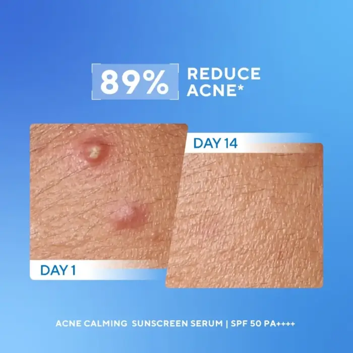 Wardah UV Shield Acne Calming Sunscreen Serum SPF 50 PA++++ - Gambar 4