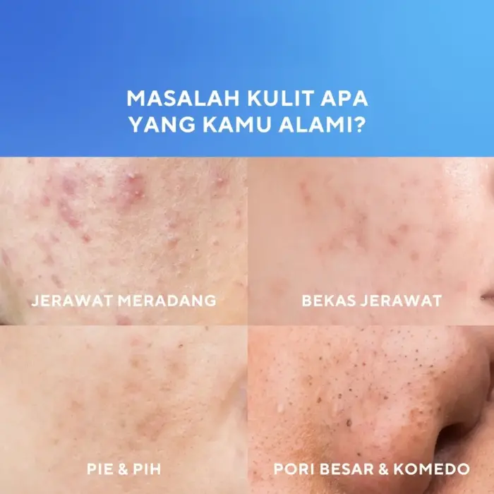 Wardah UV Shield Acne Calming Sunscreen Serum SPF 50 PA++++ - Gambar 3