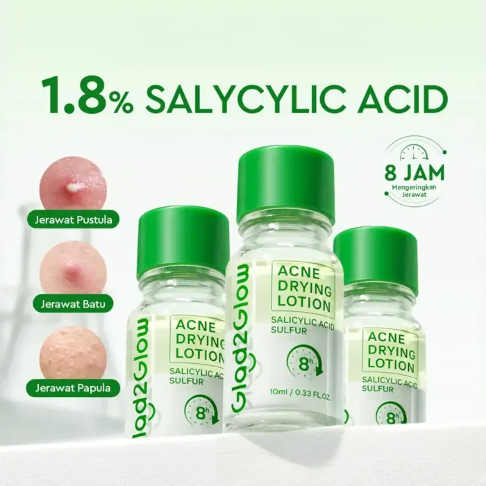 Glad2Glow Acne Drying Lotion Set - Mengeringkan Jerawat - Gambar 9