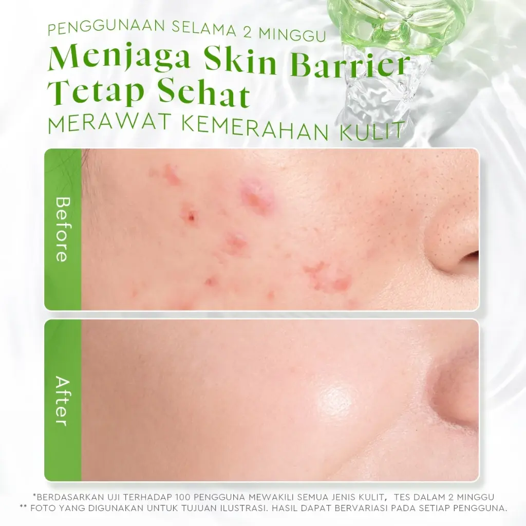 Glad2Glow Centella Ceramide Soothing Toner 3 Glad2Glow Centella Ceramide Soothing Toner - Gambar 3